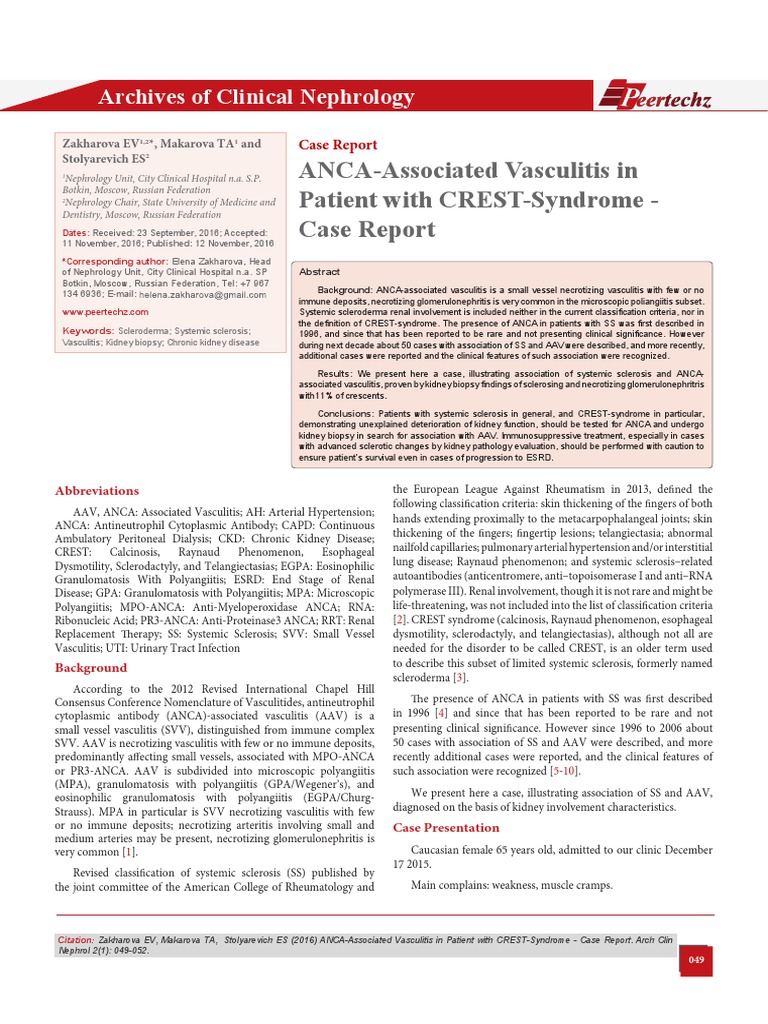 ANCAAssociated Vasculitis in Patient with CRESTSyndrome Case Report