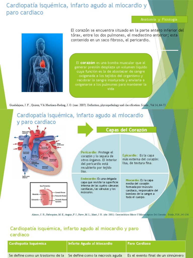 Fisiopatología del Infarto Agudo al Miocardio | PDF | Infarto de ...