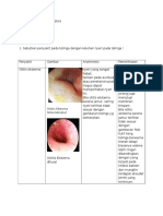 1. Otalgia (Pr Dr. Fikri)