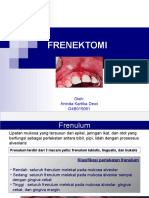 BM_57.Frenektomi.ppt