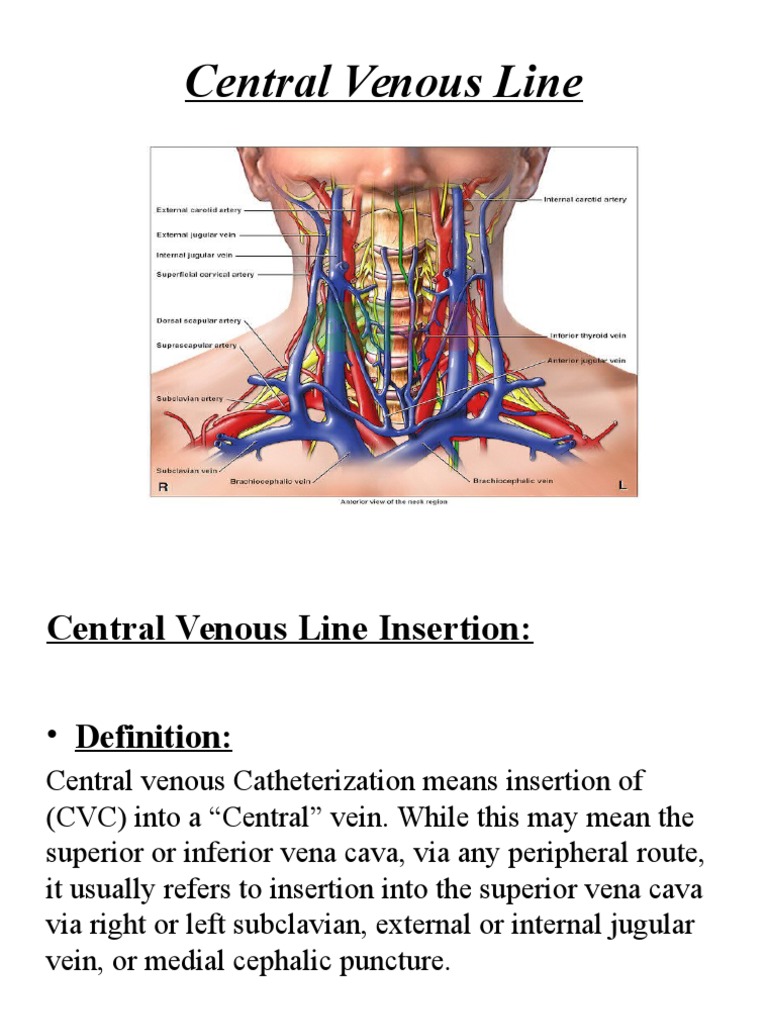 Central Venous Line | PDF | Intravenous Therapy | Health Sciences