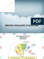 Brown-Sequard Syndrome Neuro-Farmaco Fibrinolytics