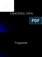 Cancer Oral I