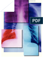 RX de Torax Interpretacion PDF