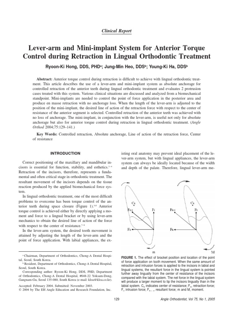 Lever arm Orthodontics Dentistry