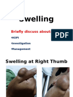 OT Discussion Swelling