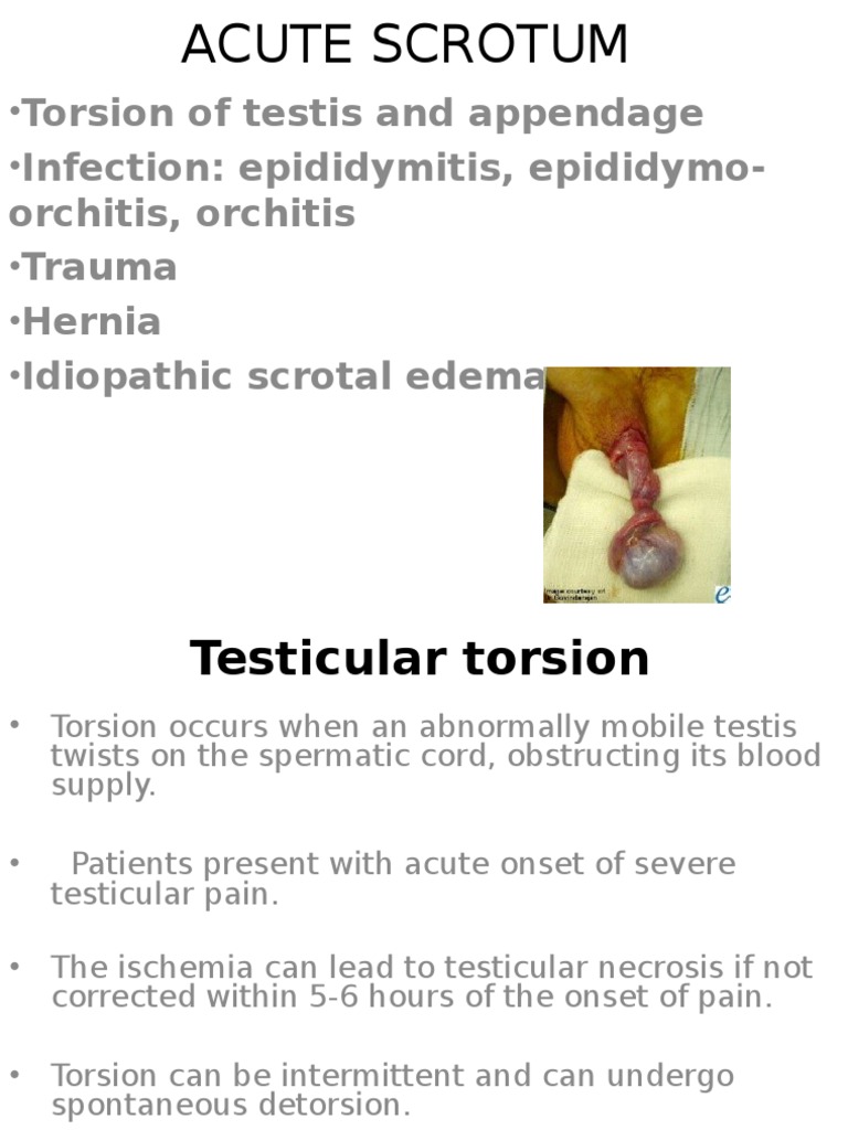 Acutescrotum 141125014842 Conversion Gate01 PDF Testicle Diseases