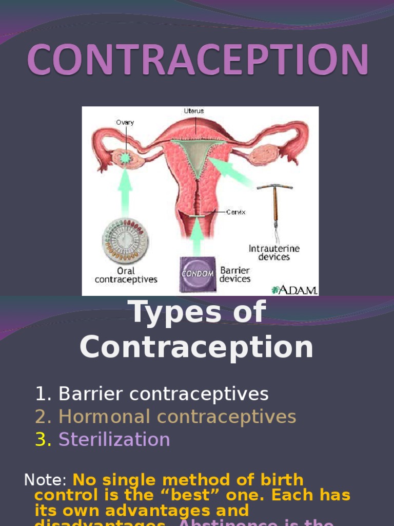 CONTRACEPTION Lecture.ppt | Birth Control | Condom