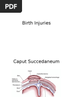 Birth Injuries