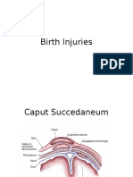 birth_injuries (1).pptx