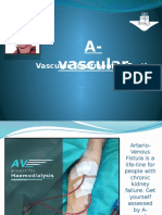 Vascular Treatment in Perth