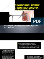 Nasofaringoskopi Untuk Deteksi Dini Naso Faring Karsinoma Nasofaring