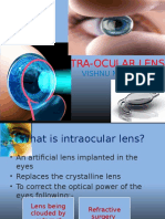 Intra-Ocular Lens: Vishnu Narayanan