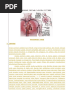 Download Laporan Pendahuluan Unstable Angina Pectoris by Tika SN334587272 doc pdf