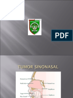 128115507 Askep Tumor Sinonasal New Ppt