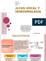 Sulcus Vocal y Laringomalasia