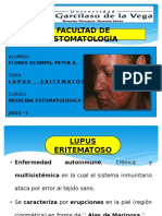 Lupus Eritematoso (Expo - Final)