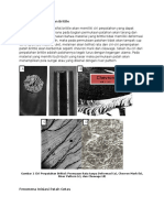 Fractografi Perpatahan Brittle