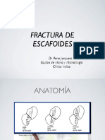 Fractura de Escafoides