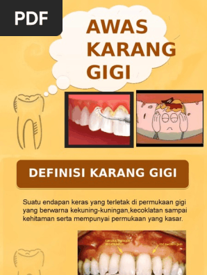 Karang Gigi Pdf