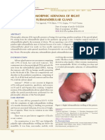 14.Pleomorphic Adenoma of Right Submandibular Gland