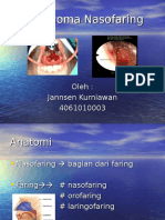 Tumor Nasofaring