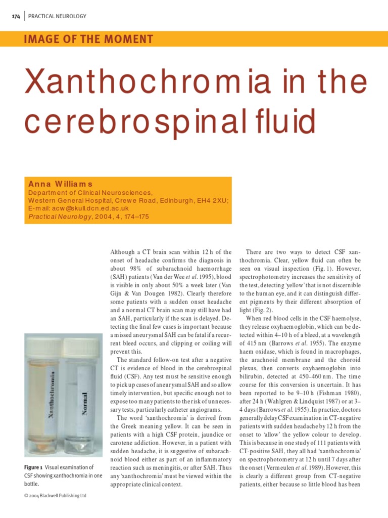 XANTHOCROMIA Clinical Medicine Medical Specialties