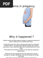 Group 1 Oedema in Pregancy