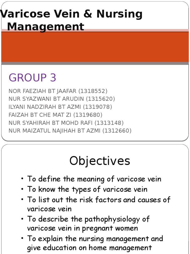 Important Nursing Considerations for Varicose Veins