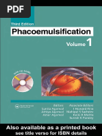 Phacoemulsification v1