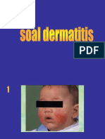 Dermatitis