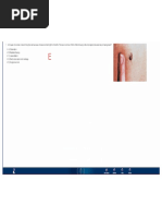Nbme Internal Form 1 Corrected 1 1 Sepsis Immunology