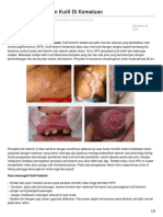 Cara Menghilangkan Kutil Di Kemaluan