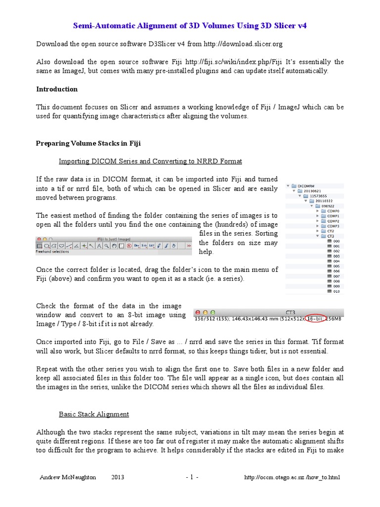 Semi Automatic Alignment 3d Volumes Slicerpdf Computer