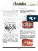 Crossbite: Classification