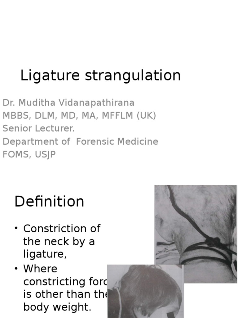 Ligature Strangulation Students.pptx Autopsy Hanging