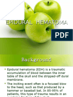 Ronny Yusyanto. Epidural Hematoma