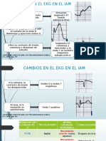 Cambios en El Ekg en El Iam