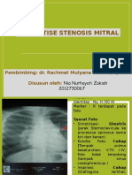 Ekspertise Stenosis Mitral