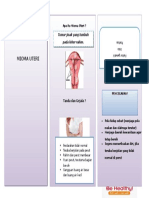 Leaflet Mioma Uteri