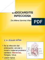 5) Endocarditis Infecciosa