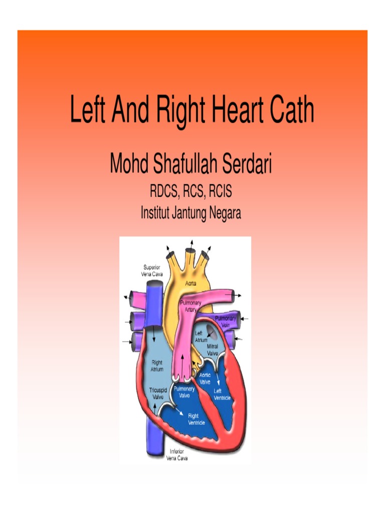 Overview of Heart Catheterization Techniques | PDF | Diastole | Blood ...