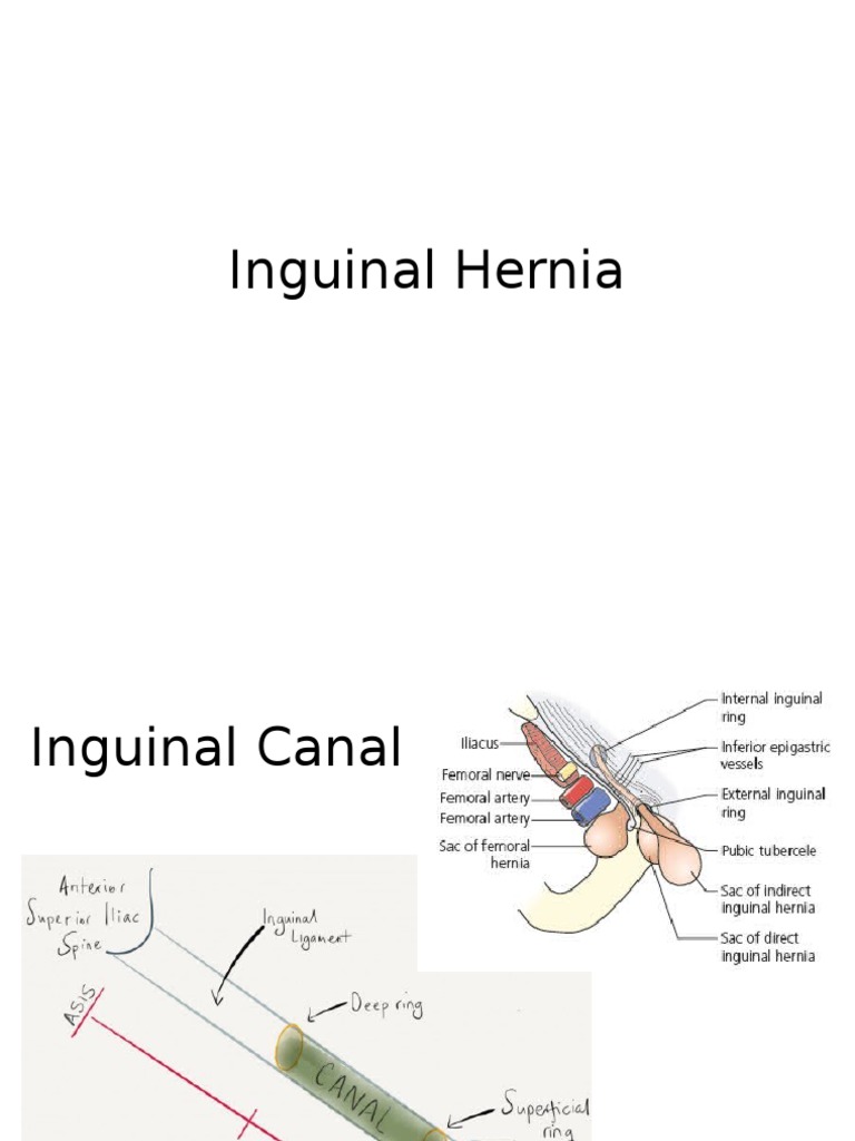 Inguinal Hernia Pdf Medical Specialties Clinical Medicine