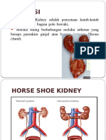 Horse Shoe Kidney