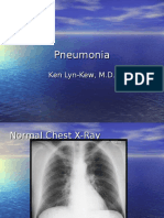 Pneumonia