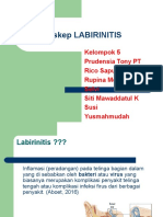 Labirinitis