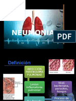 Neumonia