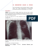 Cáncer Pulmonar: Biomagnetismo Acelera Proceso Curativo
