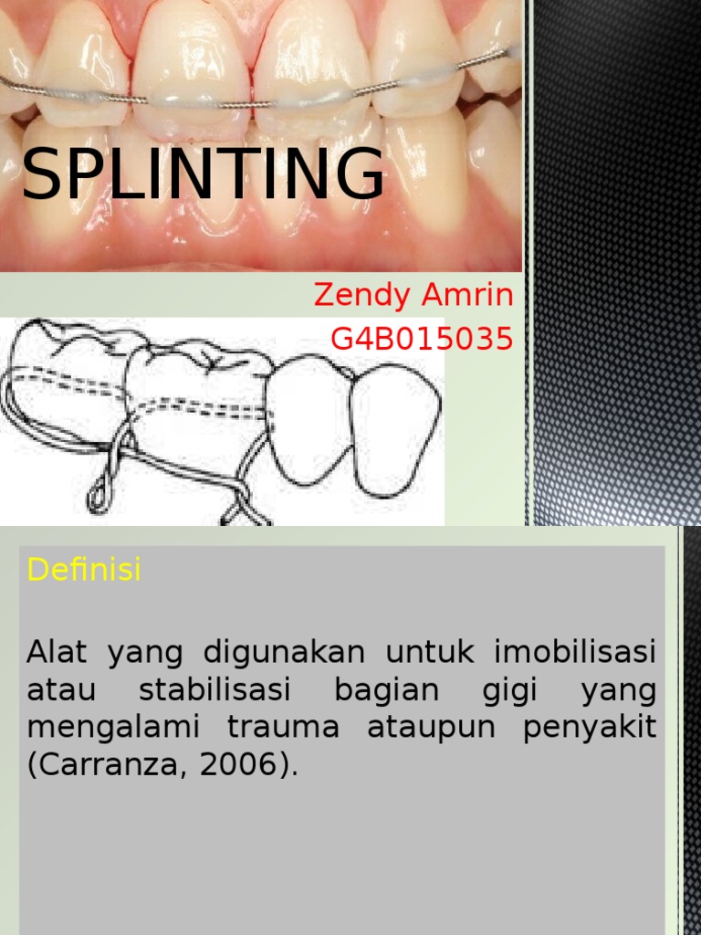 Panduan Lengkap Splinting Gigi | PDF | Kesehatan Holistik | Sains ...