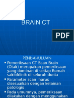 Ct Scan Brain